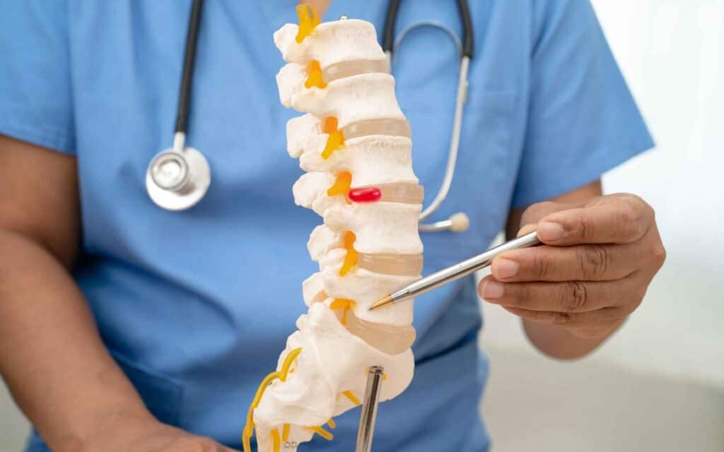 Ankylosing Spondylitis (AS)