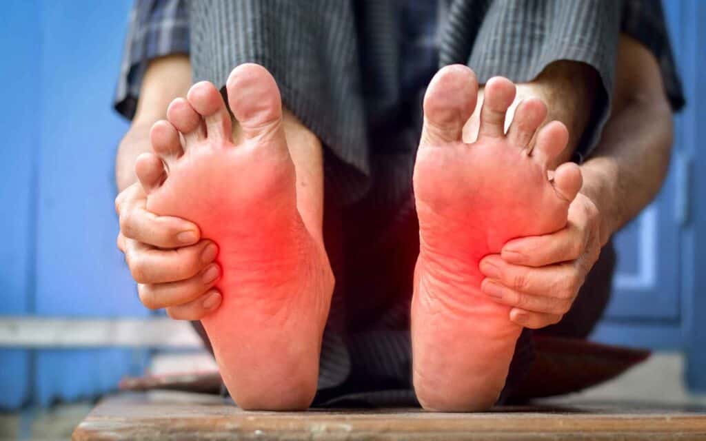 Diabetic Neuropathy
