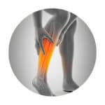 Muscular-Pain