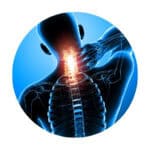 Neck-pain