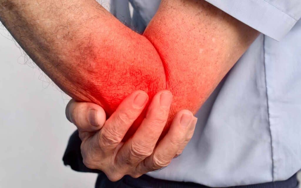 Rheumatoid Arthritis