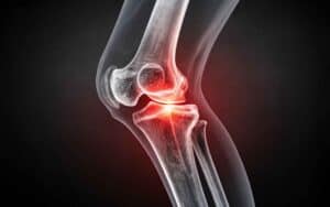 SI Joint Pain